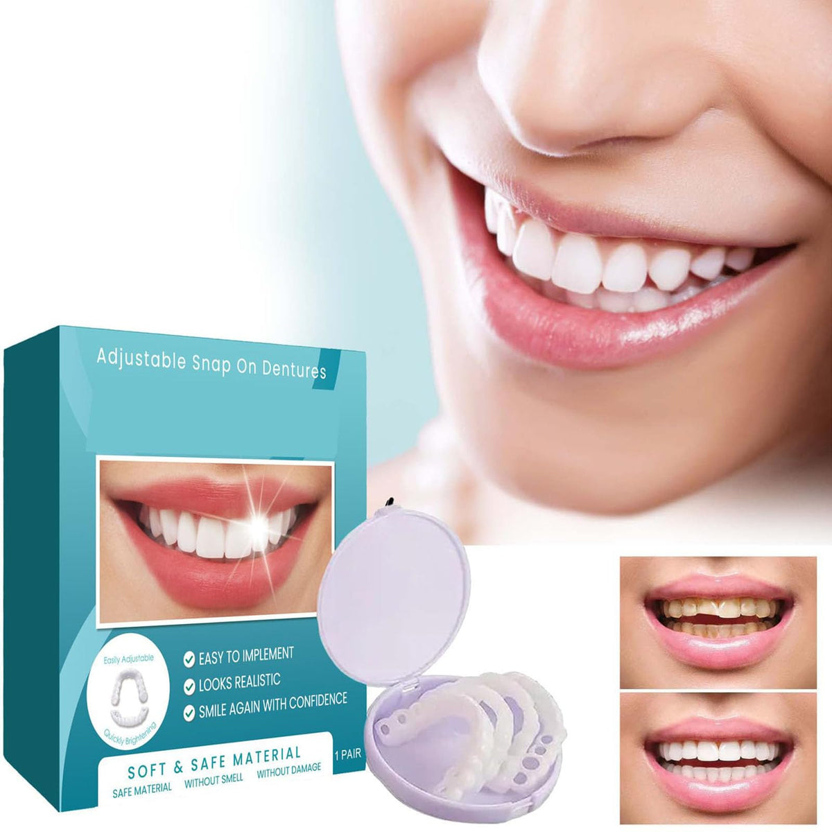 Clip on Veneers Silicone Kit for Both Upper and Lower (3Set) O4052